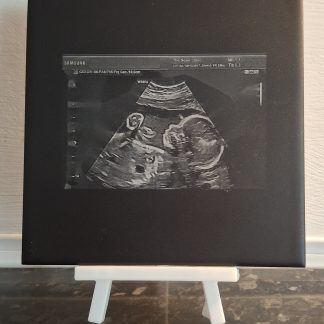 Personalised Baby Scan Ceramic Tile, complete with display stand.
